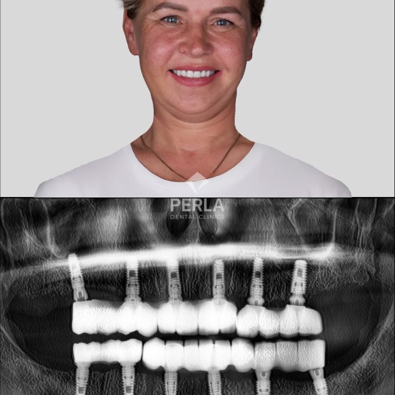 Diana Dapsauskiene kopya