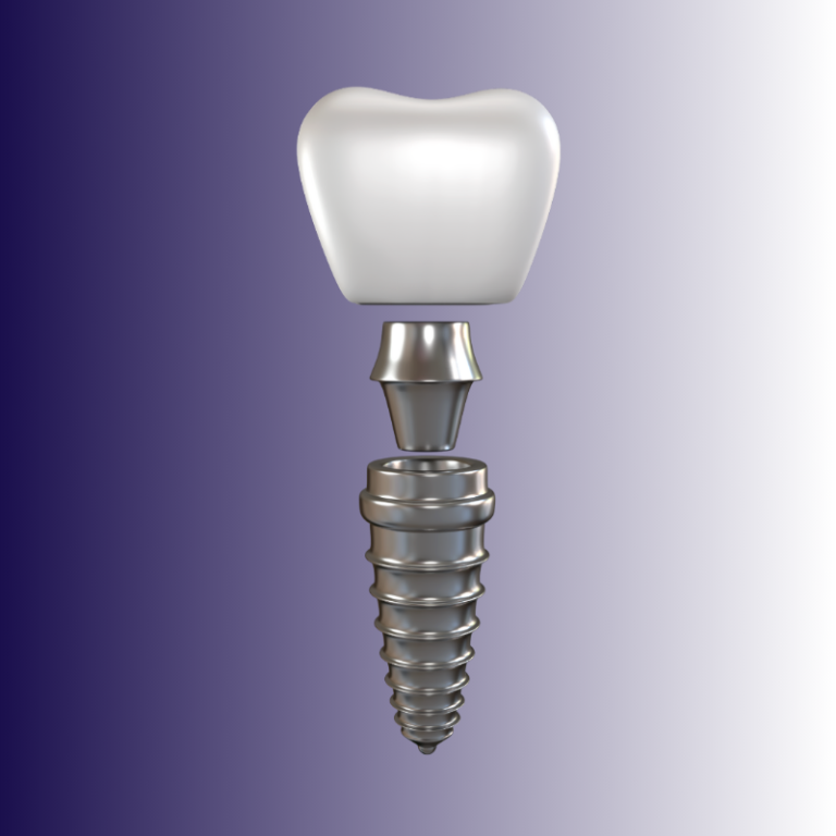 perla-implant-treatment-1719046118